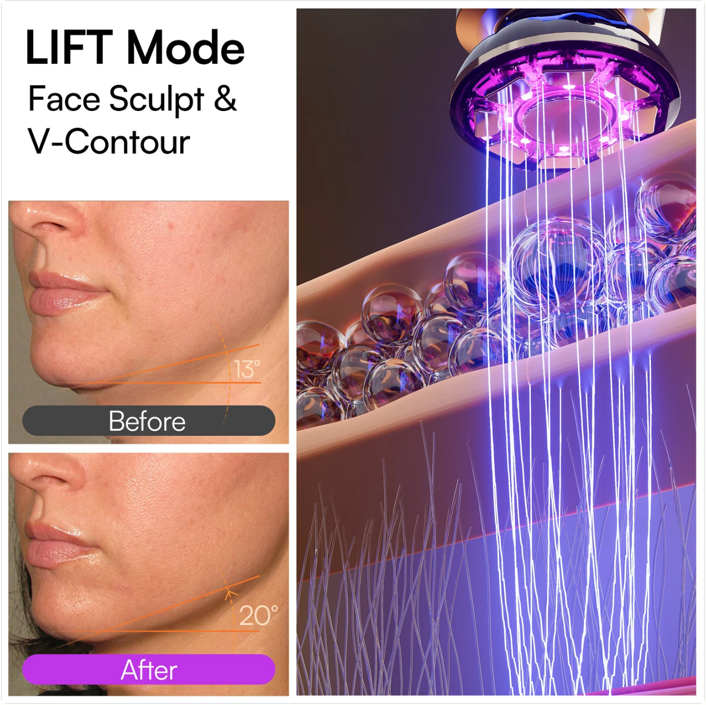 TONUS 3-in-1 Microcurrent Facial Device